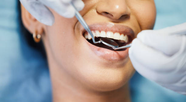 Best Cosmetic Emergency Dentistry in New Lebanon, OH